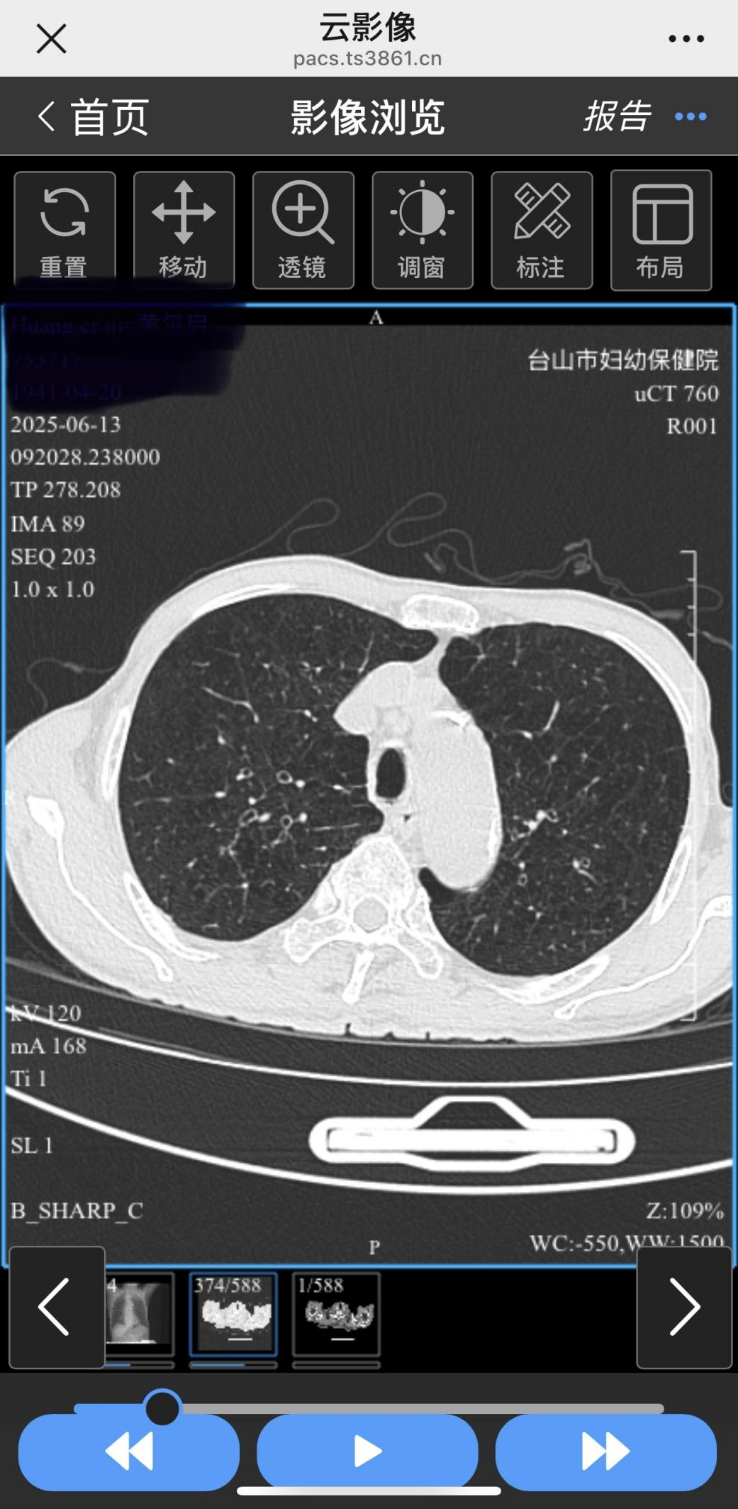放射科怎么打印台山妇幼“云胶片”服务暖心上线丨扫码即查，掌上阅片，就医体验再升级_https://www.jmylbn.com_新闻资讯_第19张