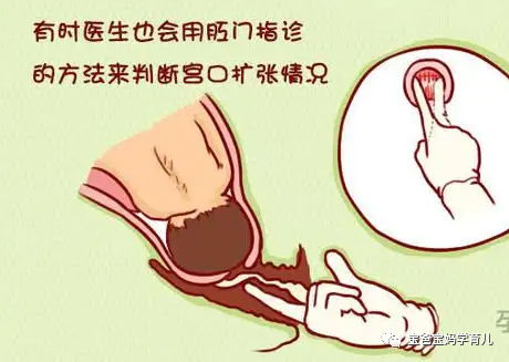 为什么要扩张宫颈开宫口，也就是医生常说的“子宫颈扩张”_https://www.jmylbn.com_新闻资讯_第1张