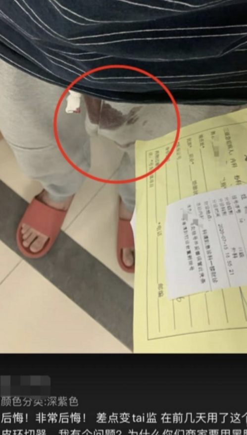 67自己动手割包皮一批男的进医院了