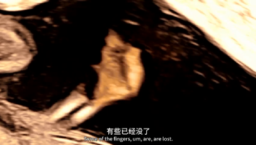 这群医生的手术台，是子宫！
