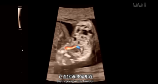 这群医生的手术台，是子宫！