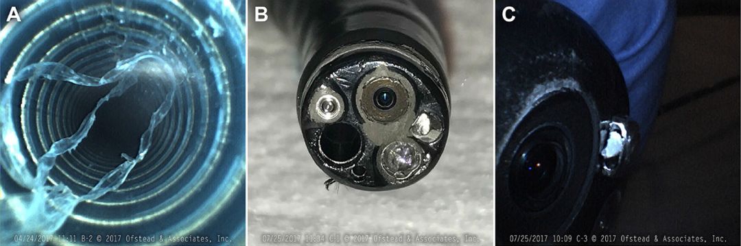 内窥镜怎么清洗怕交叉感染？一次性胃肠镜真的来了！_https://www.jmylbn.com_新闻资讯_第2张