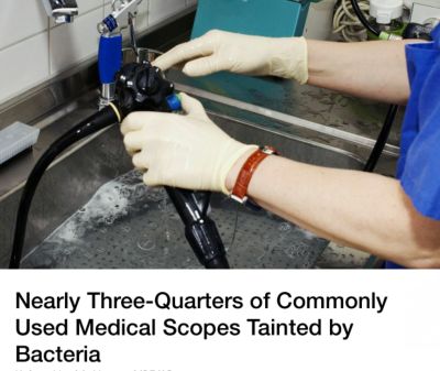 内窥镜怎么清洗怕交叉感染？一次性胃肠镜真的来了！_https://www.jmylbn.com_新闻资讯_第3张