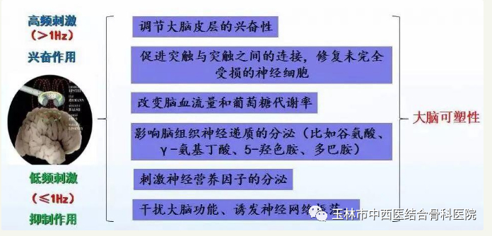 经颅磁治疗怎么样我院康复医学科引进康复“神器”——经颅磁刺激治疗仪_https://www.jmylbn.com_新闻资讯_第3张