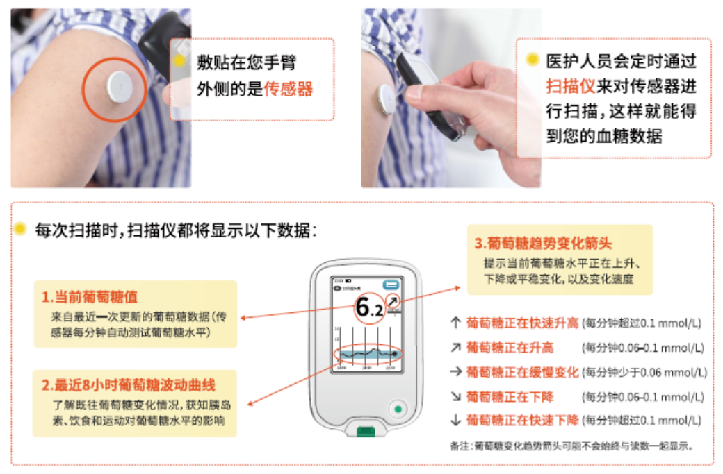 监测病人仪器叫什么血糖监测新武器——动态血糖监测仪器_https://www.jmylbn.com_新闻资讯_第4张