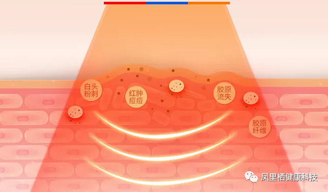 红光治疗怎么用LED光谱治疗仪---红光的妙用篇_https://www.jmylbn.com_新闻资讯_第2张