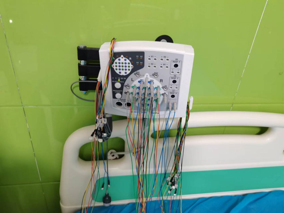 日本光电脑电图怎么样癫痫诊断的必备利器——视频脑电图_https://www.jmylbn.com_新闻资讯_第2张