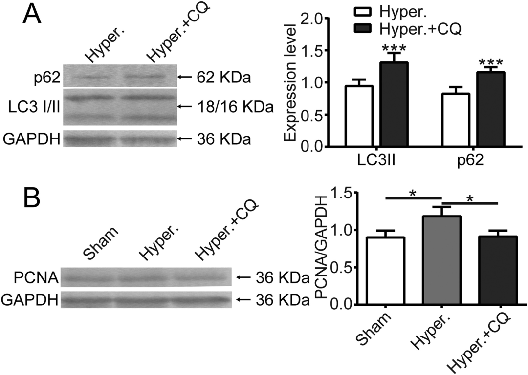 在循环拉伸应用期间，抑制的核包膜蛋白激活血管平滑肌细胞的自噬