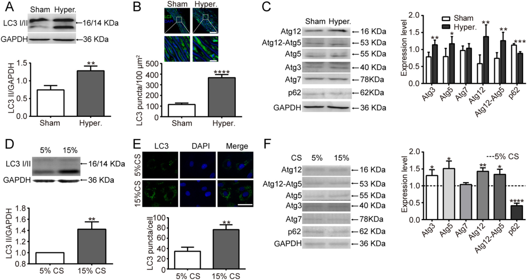 在循环拉伸应用期间，抑制的核包膜蛋白激活血管平滑肌细胞的自噬