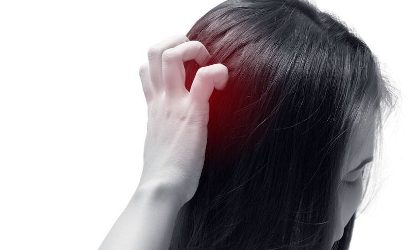 你的头皮处于“健康危机”吗？