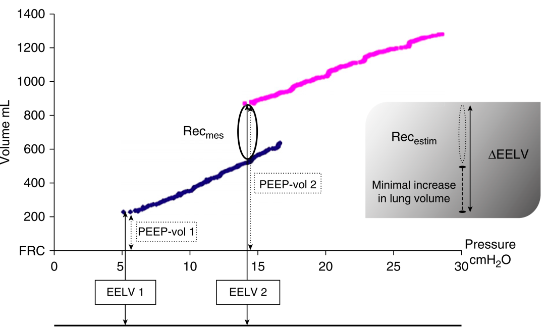 med压力怎么弄急性呼吸窘迫综合征呼气末正压设定_https://www.jmylbn.com_新闻资讯_第2张