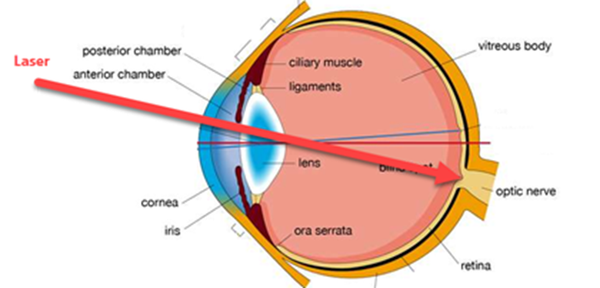 用于眼睛像差评估的Shack‑Hartmann传感器建模的图1