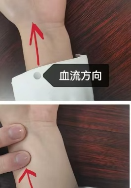 桡动脉鞘怎么读动脉鞘管拔除后按压要点荟萃_https://www.jmylbn.com_新闻资讯_第3张