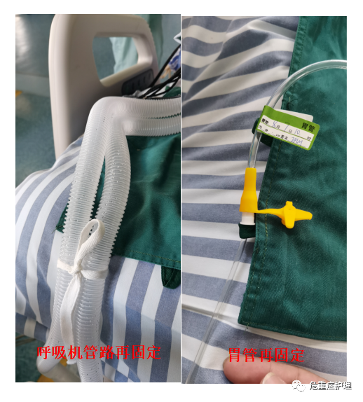 翻身垫怎么用ICU患者翻身不便？试试这款辅助翻身的多功能护理垫吧！_https://www.jmylbn.com_新闻资讯_第4张