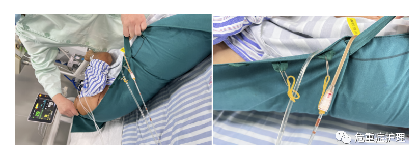翻身垫怎么用ICU患者翻身不便？试试这款辅助翻身的多功能护理垫吧！_https://www.jmylbn.com_新闻资讯_第3张