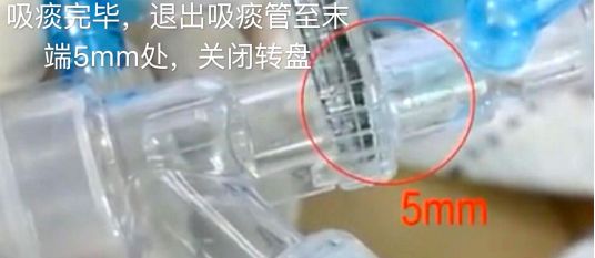 为什么使用密闭式吸痰管如何规范进行密闭式吸痰？这些内容说的很清楚！_https://www.jmylbn.com_新闻资讯_第3张