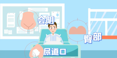 输尿管导管是什么留置导尿管，这些知识你必须知道！_https://www.jmylbn.com_新闻资讯_第16张