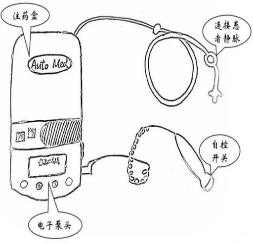 电子镇痛泵怎么使用镇痛棒是个什么“棒”？_https://www.jmylbn.com_新闻资讯_第8张