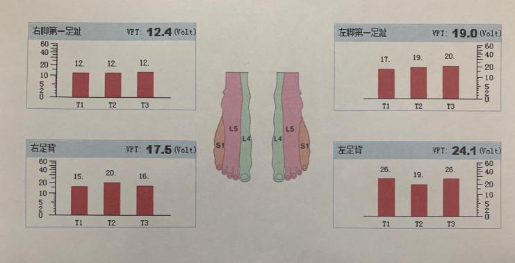 为什么糖尿病不能震动科普 ｜ 糖尿病并发症筛查之震动感觉阈值检测_https://www.jmylbn.com_新闻资讯_第4张