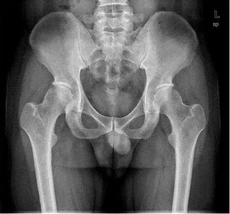 d-spect怎么检查【核医学科普】SPECT-CT全身骨显像wholebody bone scan给全身骨骼拍张“艺术照”_https://www.jmylbn.com_新闻资讯_第22张