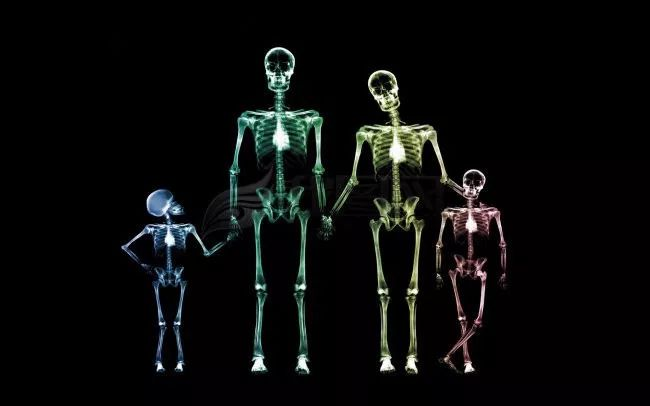 d-spect怎么检查【核医学科普】SPECT-CT全身骨显像wholebody bone scan给全身骨骼拍张“艺术照”_https://www.jmylbn.com_新闻资讯_第11张