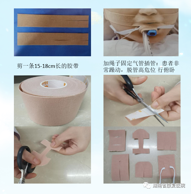 体表导管固定怎么使用用心呵护 “管”定安全——巧用弹性柔棉宽胶带制作导管固定贴_https://www.jmylbn.com_新闻资讯_第7张