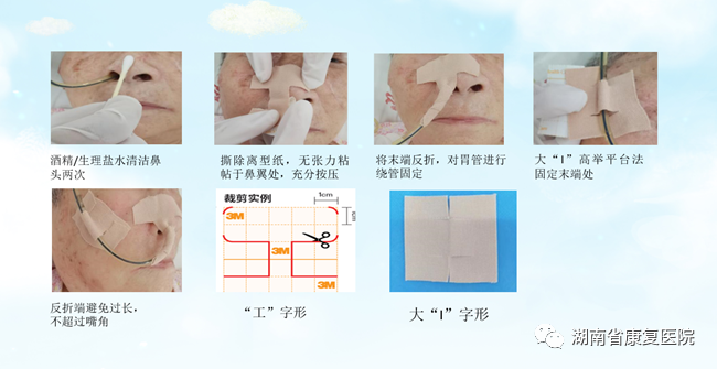 体表导管固定怎么使用用心呵护 “管”定安全——巧用弹性柔棉宽胶带制作导管固定贴_https://www.jmylbn.com_新闻资讯_第2张