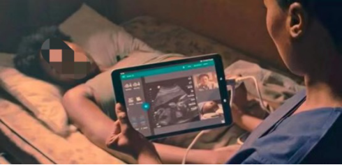 索诺星超声怎么样【康医科普】手持超声--临床医生武器_https://www.jmylbn.com_新闻资讯_第12张