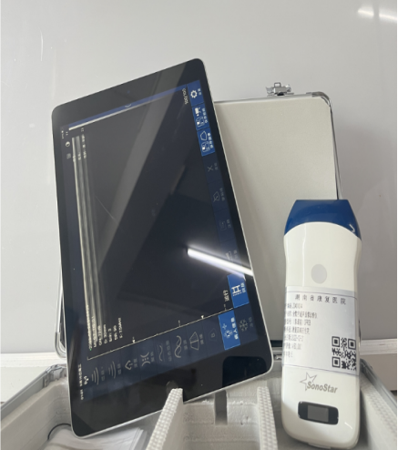 索诺星超声怎么样【康医科普】手持超声--临床医生武器_https://www.jmylbn.com_新闻资讯_第13张