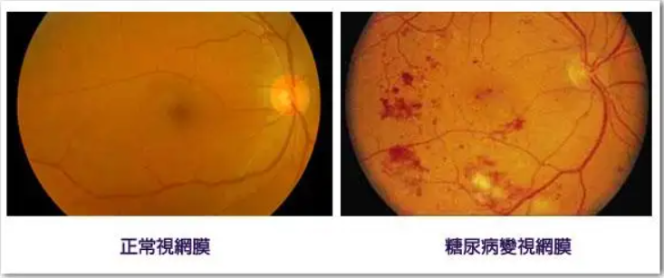 dr临床用于什么每周一药 ｜ DR类-上海聚慕医疗器械有限公司