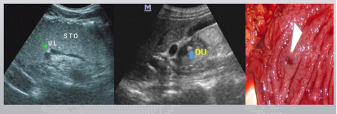 胃造影用的是什么机子胃肠超声造影--无创、无痛、无辐射！_https://www.jmylbn.com_新闻资讯_第22张