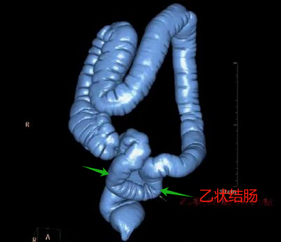 胃造影用的是什么机子胃肠超声造影--无创、无痛、无辐射！_https://www.jmylbn.com_新闻资讯_第17张
