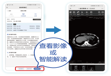 dr胶片怎么看手机查报告，CT  MRI  DR影像掌上看.......玉山中医院医学影像“云”平台上线！_https://www.jmylbn.com_新闻资讯_第5张