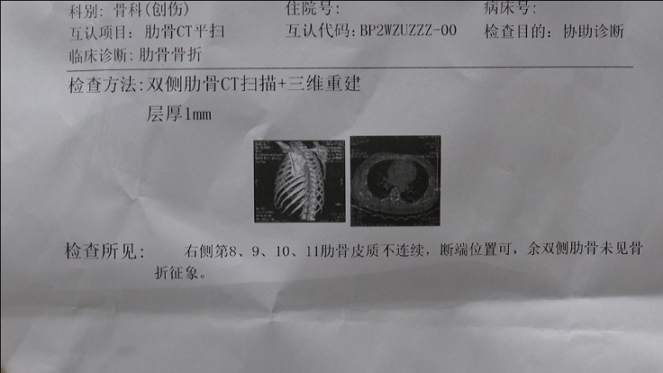 而王松则是第8根至11根肋骨骨折陆建定尾椎骨轻微受伤经医学鉴定两位