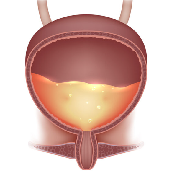10分钟一次小便,不一定是肾虚,可能膀胱出现了这个疾病_医学界-助力