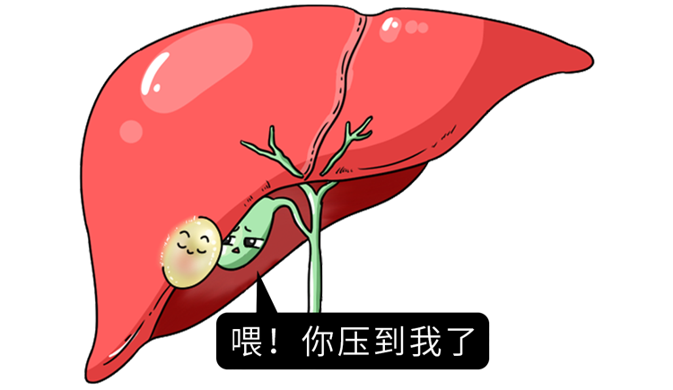 腰痛无力？当心肾脏长了这种异物，直径可达10cm！