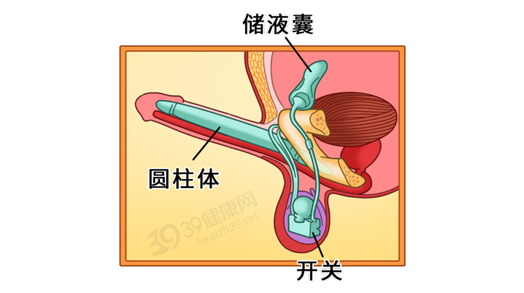 7�治疗并不困难事实上"这可是男人最大的耻辱"宁可断头,也不