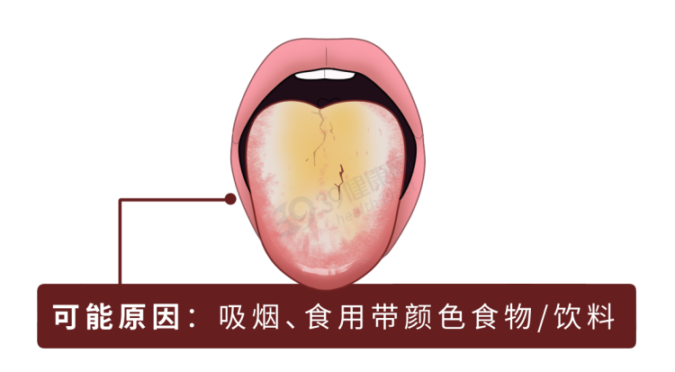 舌头下面黑色图片