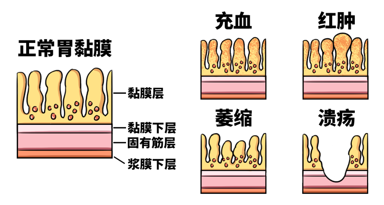 人體最脆弱的一層膜，有多容易被摧毀？ 健康 第12張