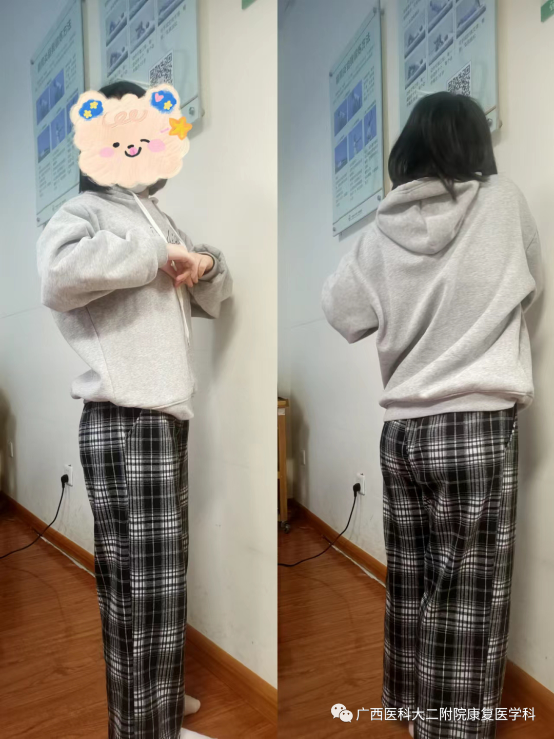 悬吊训练系统 怎么装S-E-T悬吊训练技术在下背痛中的应用_https://www.jmylbn.com_新闻资讯_第8张