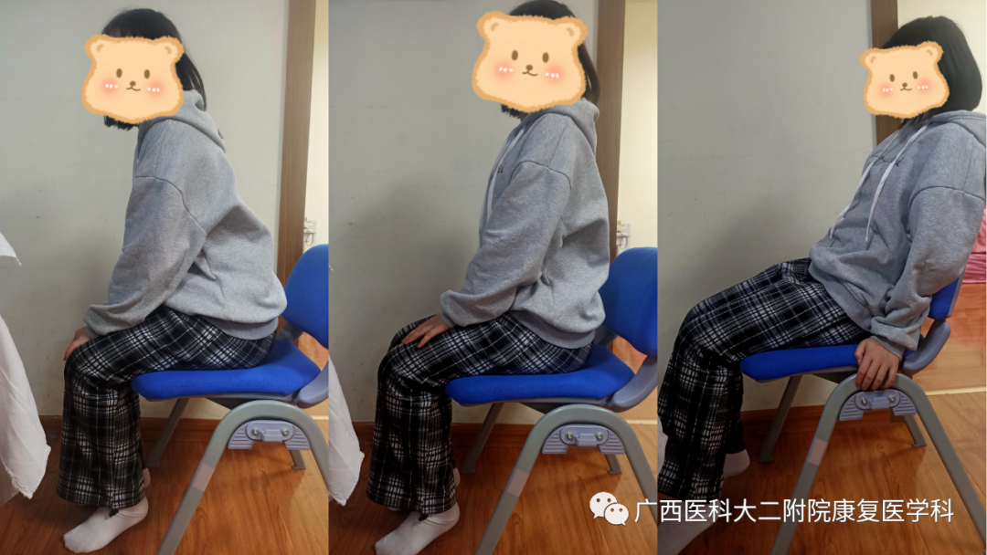 悬吊训练系统 怎么装S-E-T悬吊训练技术在下背痛中的应用_https://www.jmylbn.com_新闻资讯_第7张