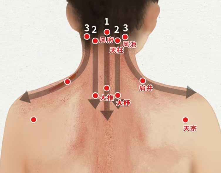 用刮痧板自己怎么刮脸身体有結节、淤堵的人，这个地方会鼓包_https://www.jmylbn.com_新闻资讯_第18张