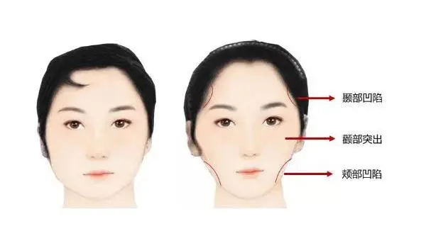 牙科材料硅胶怎么用如何使用咬胶？试试这些小技巧！_https://www.jmylbn.com_新闻资讯_第4张