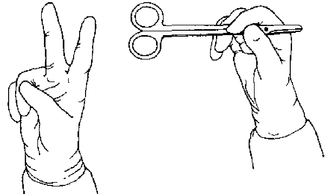 为什么要结扎血管谈骨论筋丨最全的外科手术基本功，别怪我没告诉你！_https://www.jmylbn.com_新闻资讯_第12张