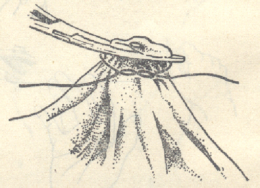 为什么要结扎血管谈骨论筋丨最全的外科手术基本功，别怪我没告诉你！_https://www.jmylbn.com_新闻资讯_第25张