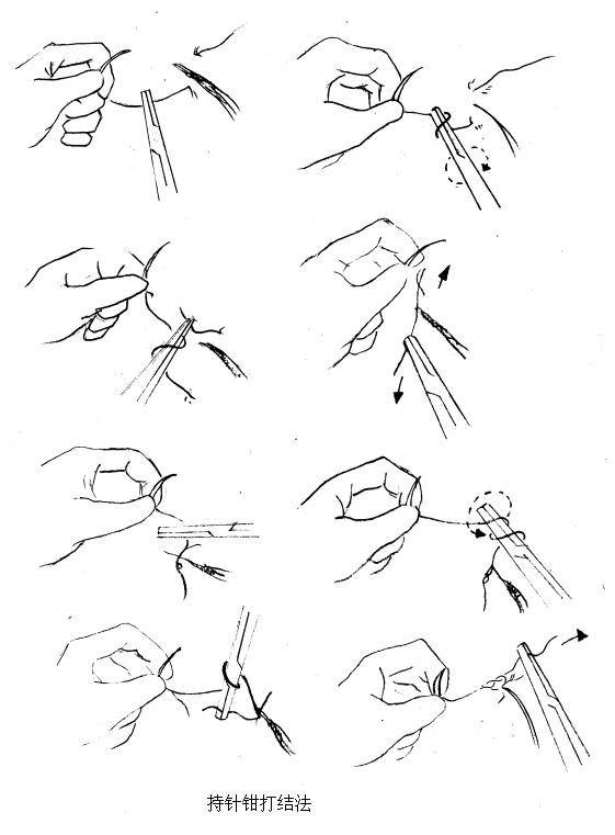 为什么要结扎血管谈骨论筋丨最全的外科手术基本功，别怪我没告诉你！_https://www.jmylbn.com_新闻资讯_第40张