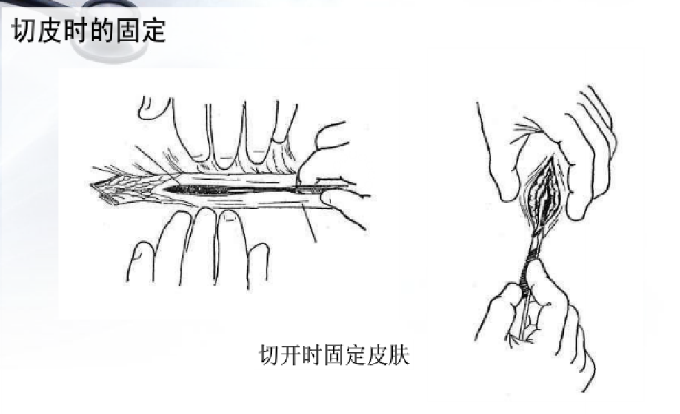 为什么要结扎血管谈骨论筋丨最全的外科手术基本功，别怪我没告诉你！_https://www.jmylbn.com_新闻资讯_第21张
