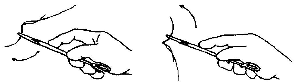 为什么要结扎血管谈骨论筋丨最全的外科手术基本功，别怪我没告诉你！_https://www.jmylbn.com_新闻资讯_第15张