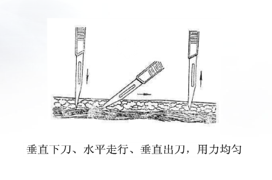 为什么要结扎血管谈骨论筋丨最全的外科手术基本功，别怪我没告诉你！_https://www.jmylbn.com_新闻资讯_第22张