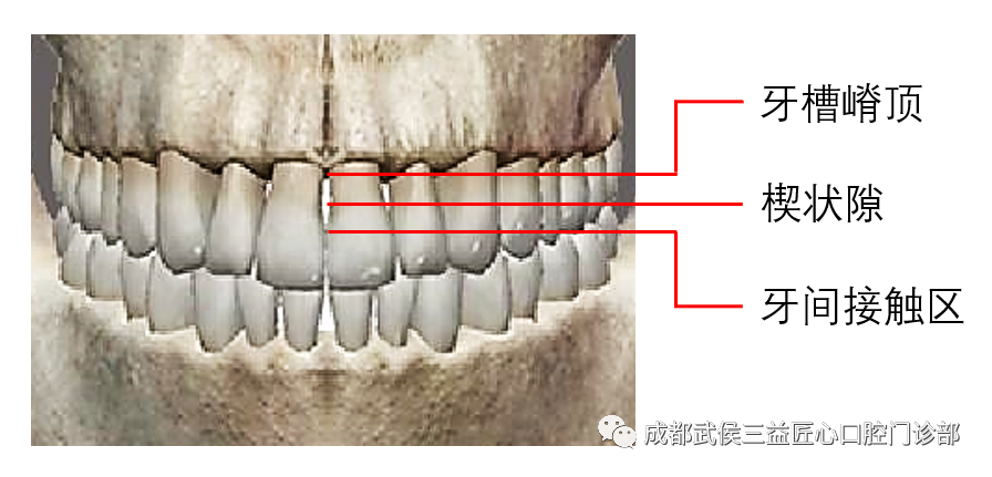 所以在两颗牙齿靠拢的区域(称牙间接触区)的根方,存在一个三角形的